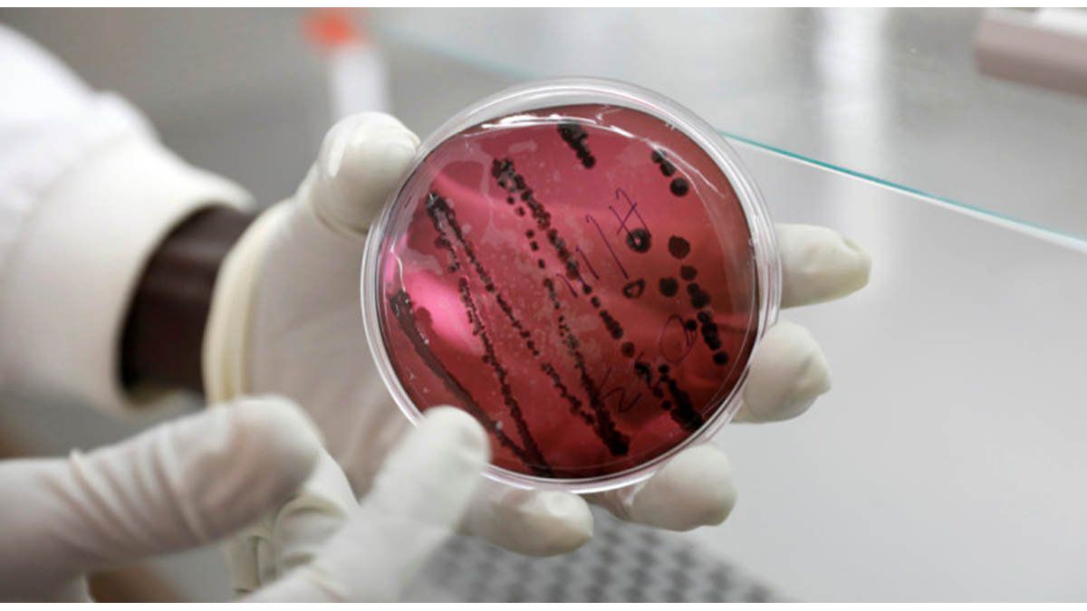 Alarma entre los científicos en Bolivia por la aparición de un nuevo virus con una letalidad similar al ébola