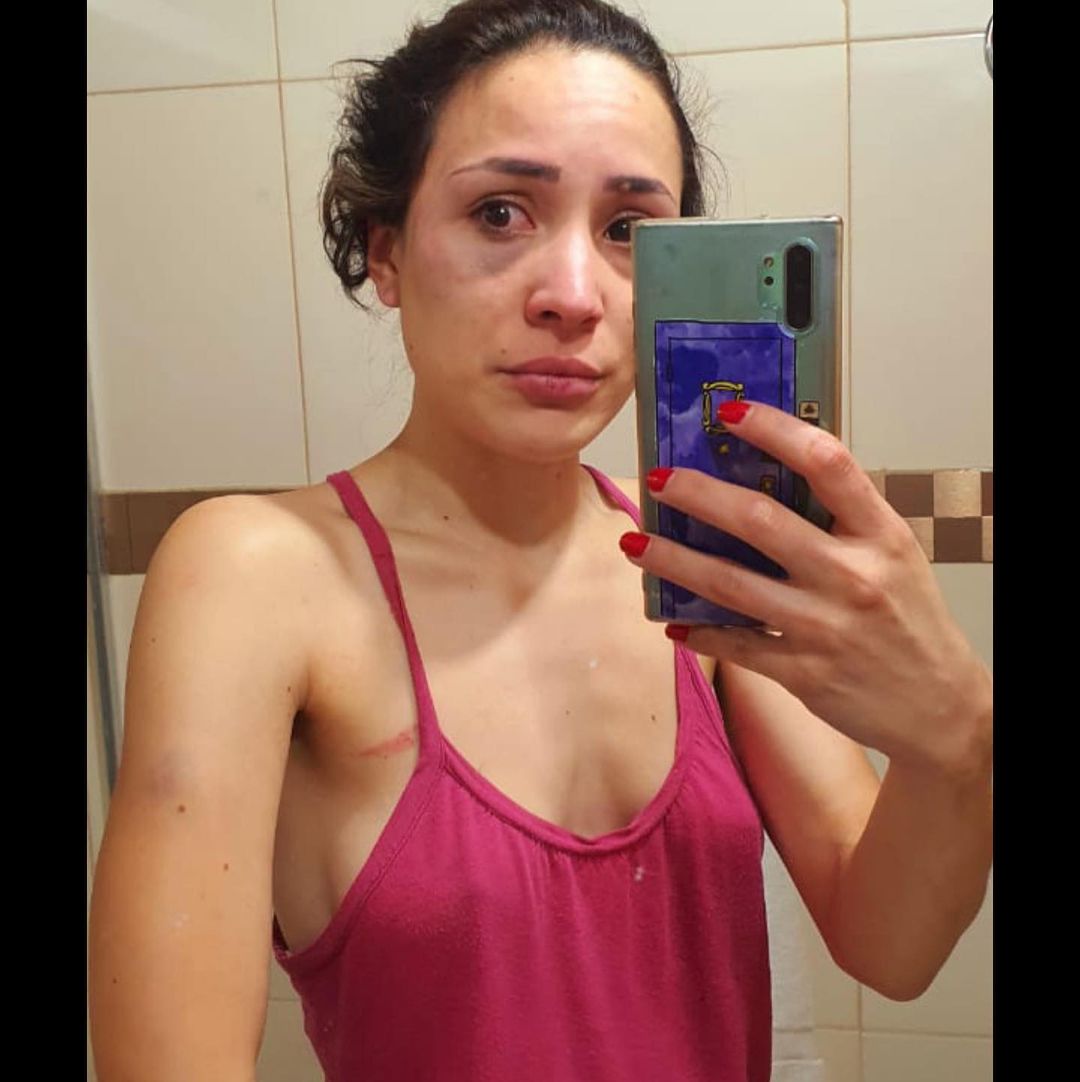 Mujer denuncia que su pareja la golpeó brutalmente: «Me dijeron que tengo suerte que no fueron a mi velorio»
