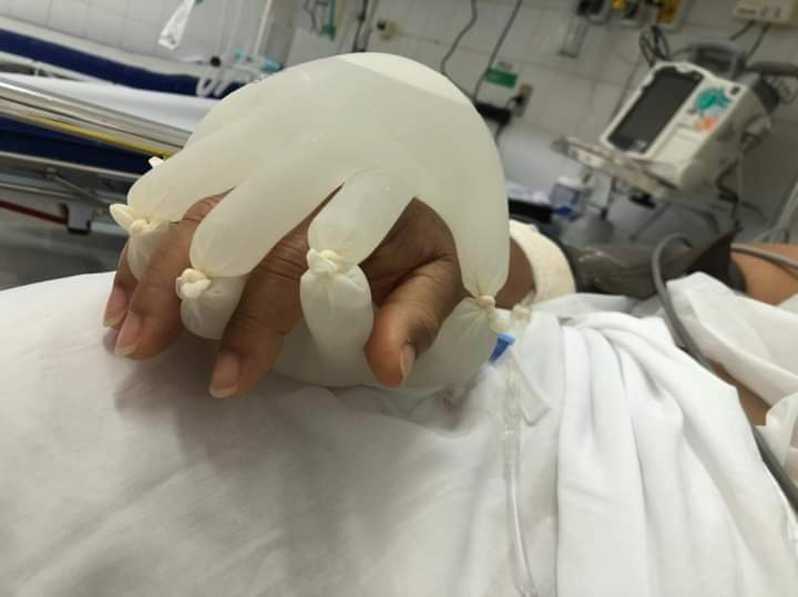 Enfermera crea guantes especiales para «acompañar» a pacientes con COVID-19
