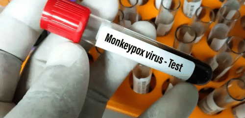 Viruela Símica: recomendaciones para el manejo de ropas de cama en hospitales