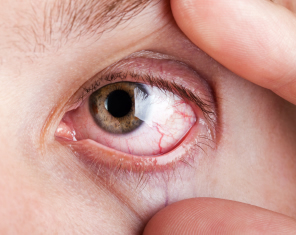 Recomendaciones para proteger los ojos ante el humo del ambiente