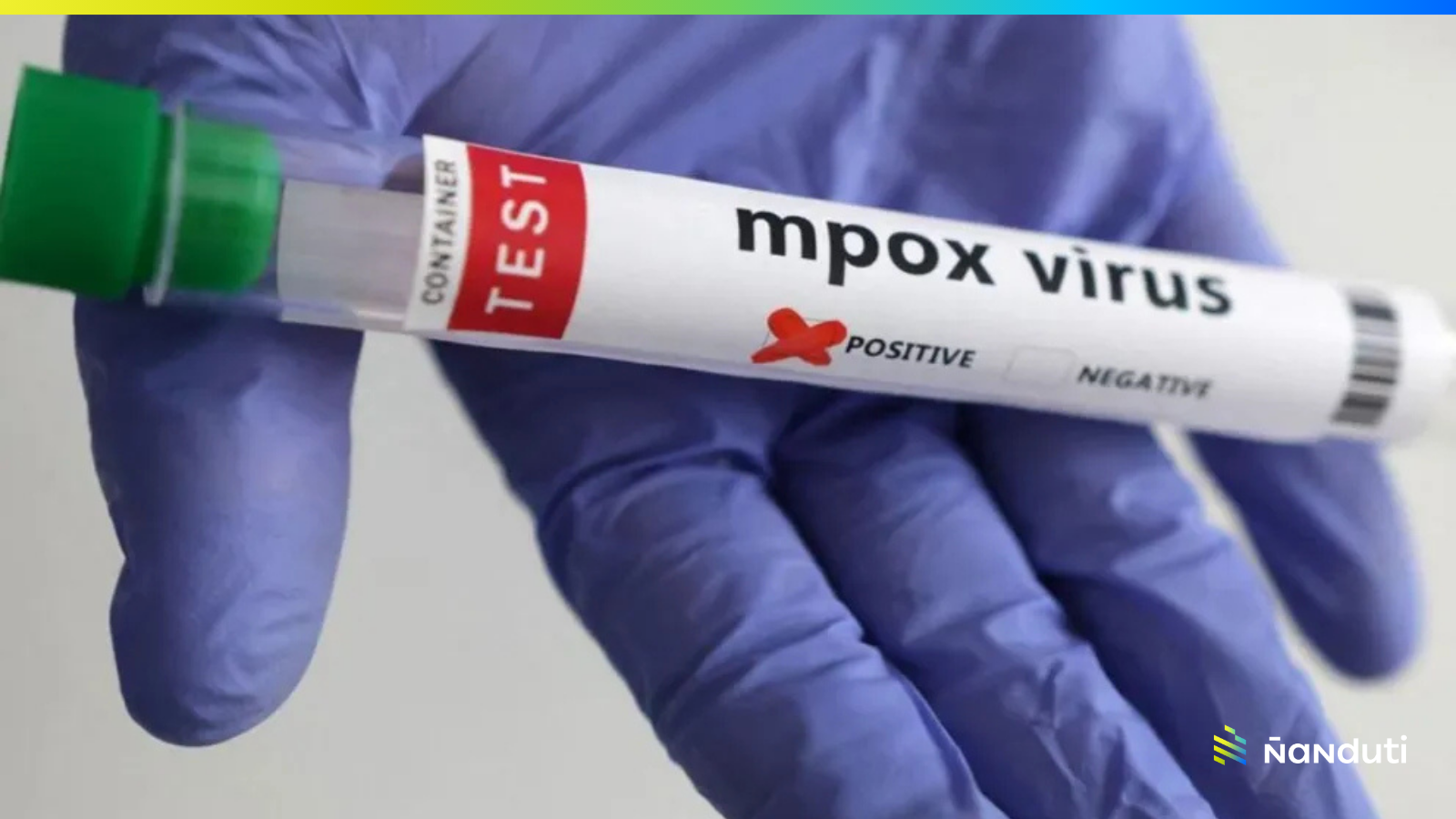 Paraguay se mantiene sin casos de Mpox según el Ministerio de Salud