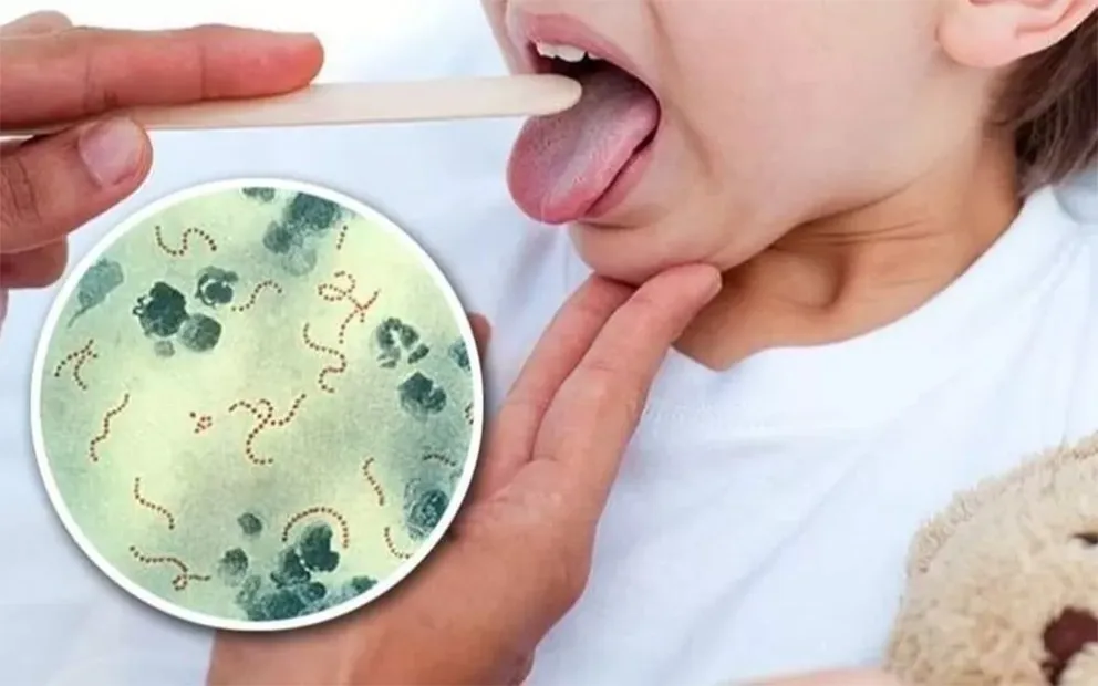 Una bacteria causó la muerte de  una niña de 13 años en Capiatá