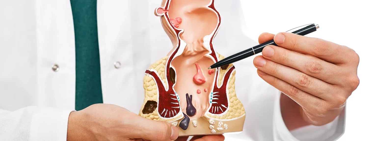 Dolor anal: La importancia de consultar a tiempo
