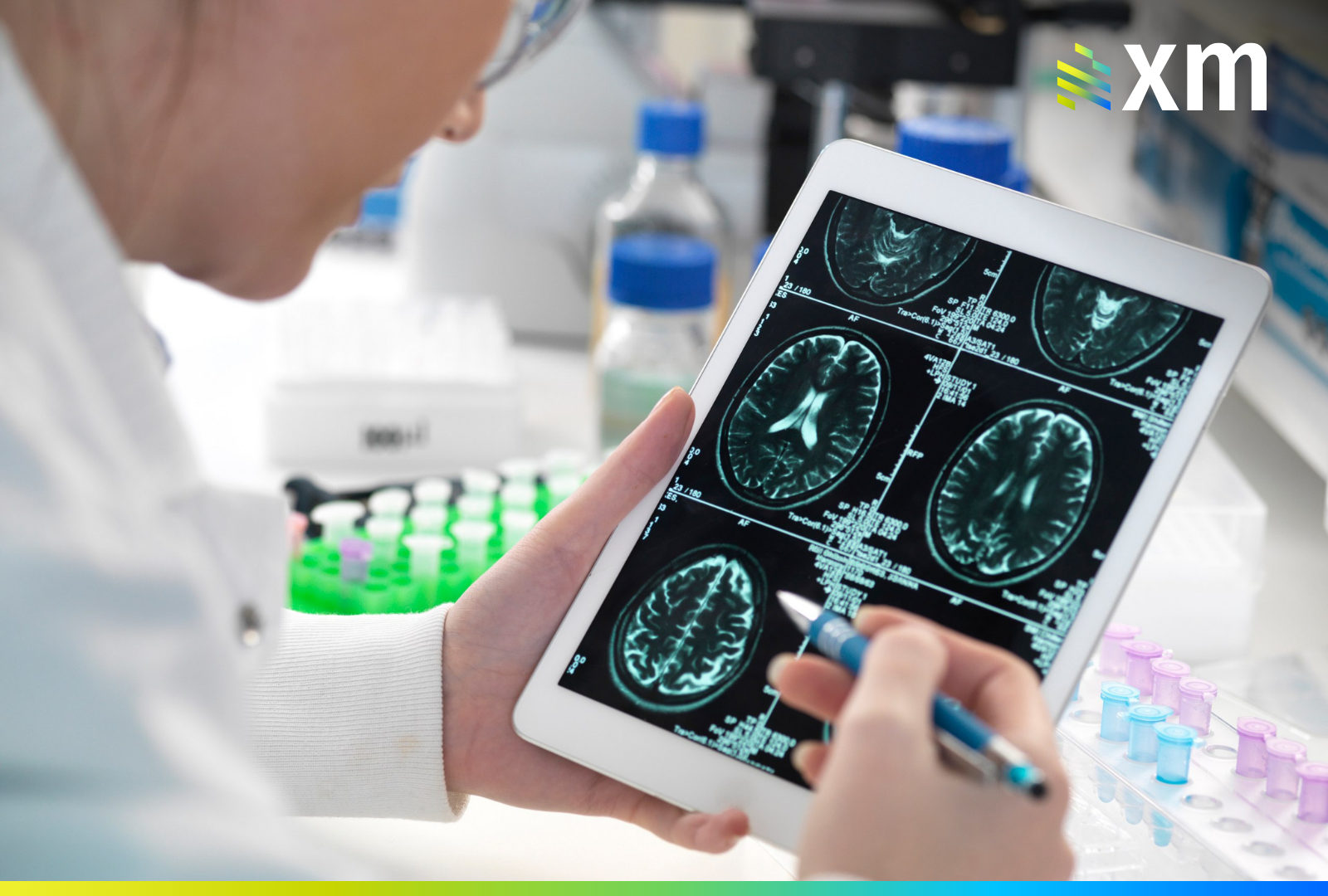 ADIUM recuerda el Día Mundial del Cerebro y la importancia del acceso a tratamientos
